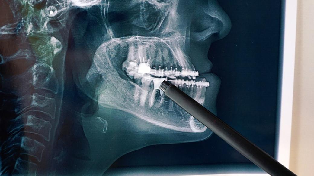 Oral & Maxillofacial Surgery Residency Program Vagelos College of