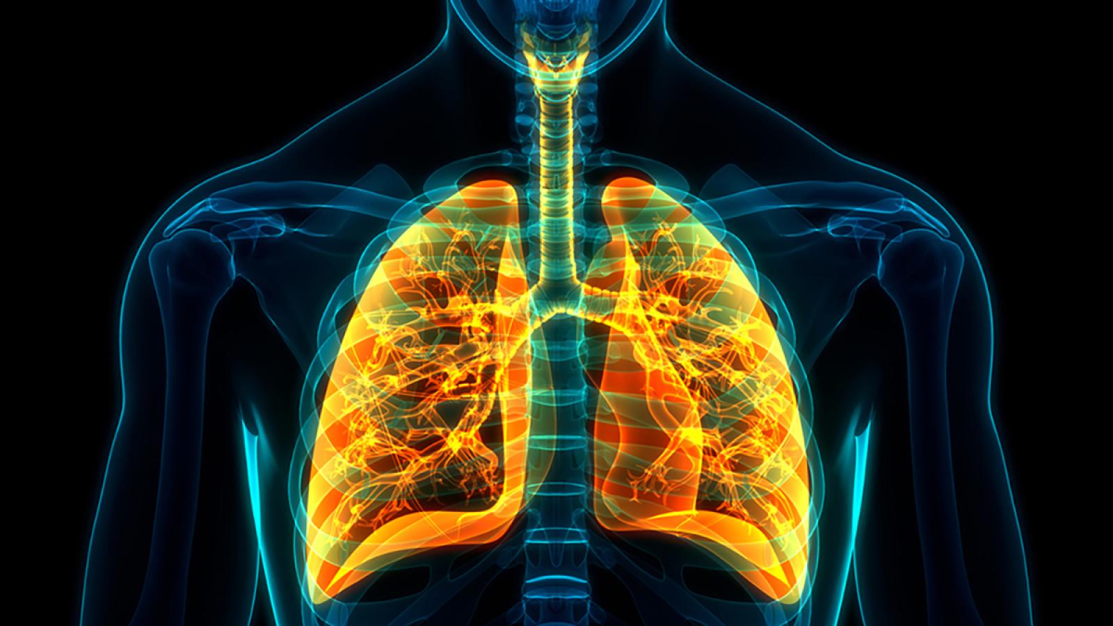 Division of Pulmonary, Allergy, and Critical Care Medicine at Columbia