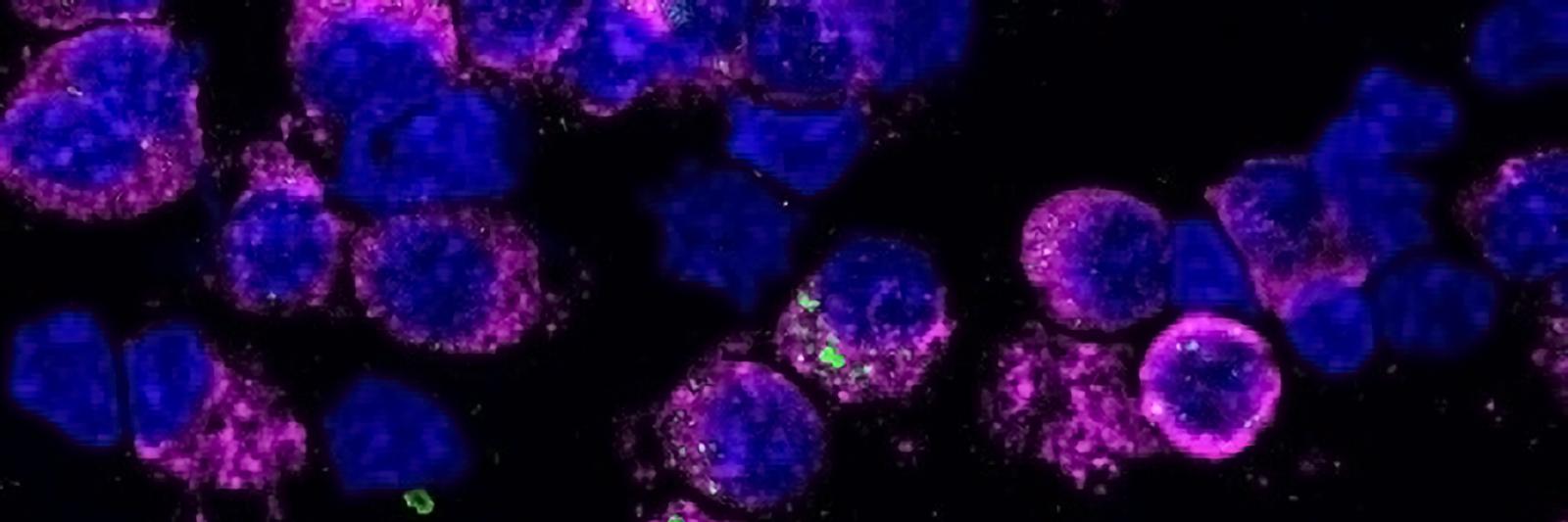 Garcia Lab Vagelos College of Physicians and Surgeons