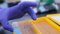 Hand, covered in a latex glove, holding up a microscopic slide image