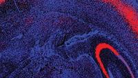 A close-up image of human tissue: red and purple swirls.