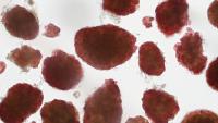 Isolated Human Islet stained red by DTZ
