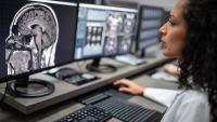 Resident examines an MRI of a brain while sitting at a workstation.