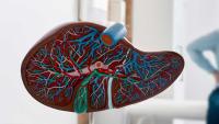 Artificial plastic model of liver.