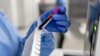 Close-up on a technician analyzing blood samples at the lab and holding a test tube.